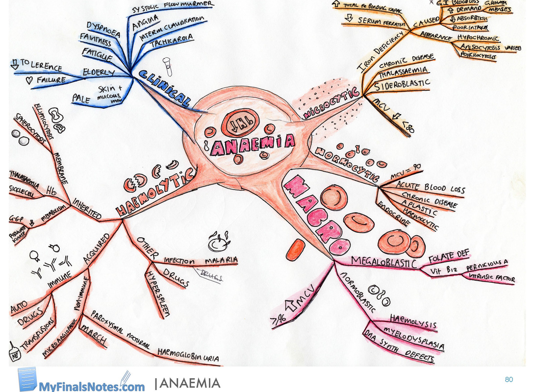 Anaemia mind map, anaemia revision notes
