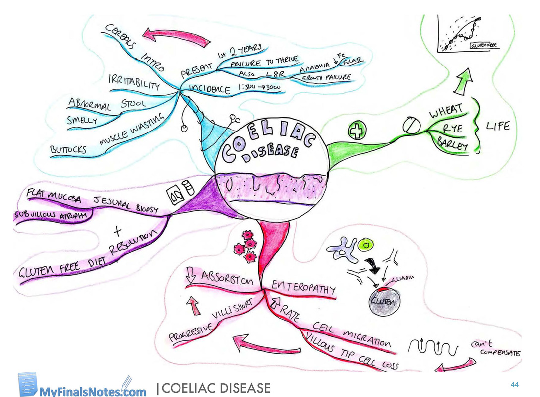 Coeliac disease mind map and revision notes, coeliac disease pathophysiology, coeliac disease investigations, coeliac disease clinical features, coeliac disease management