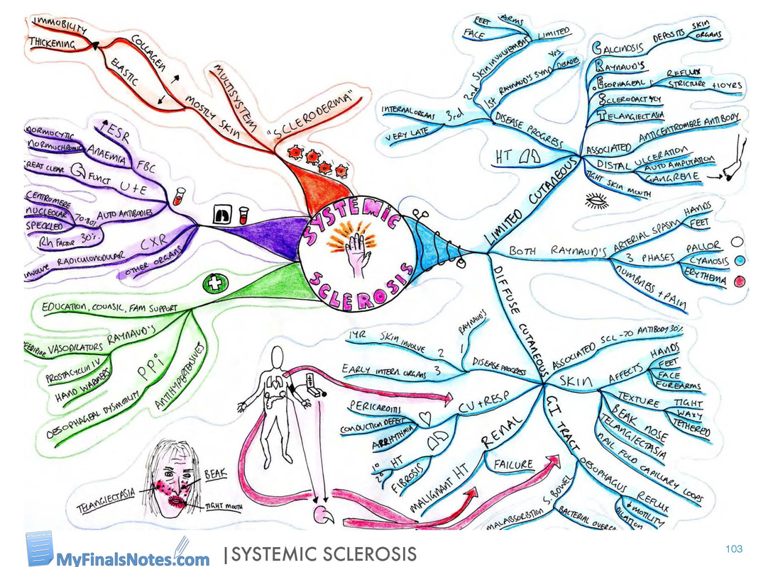Systemic Sclerosis mind map, systemic sclerosis pathophysiology, systemic sclerosis clinical features, systemic sclerosis investigations, management