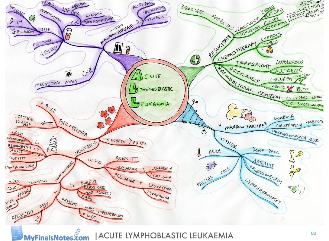 Acute Lymphoblastic Leukaemia mind map, ALL pathophysiology, ALL clinical features, ALL, investigations, ALL management