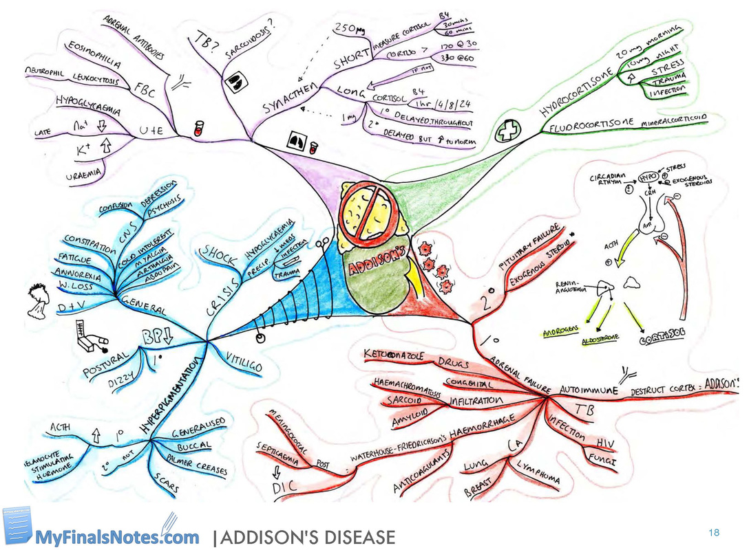 Addison's disease mind map, addisson's disease revision notes, pathophysiology, clinical features, investigations, management