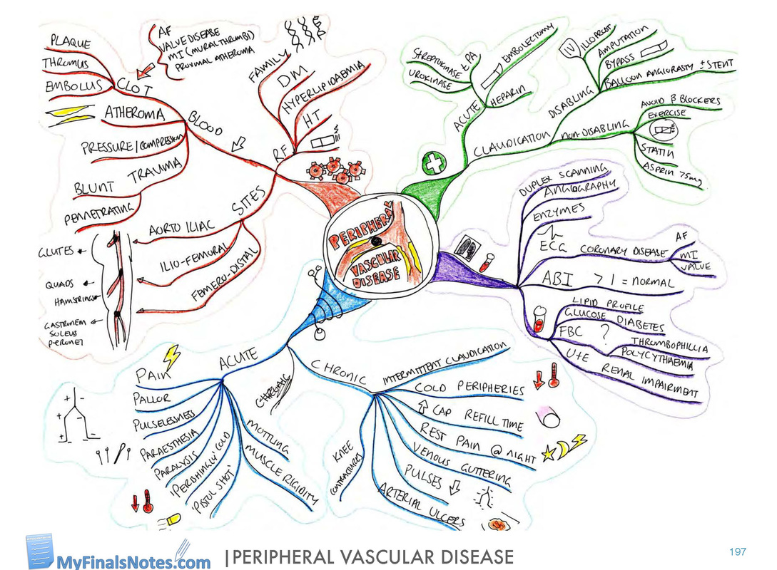 peripheral vascular disease revision notes, peripheral vascular disease mind map