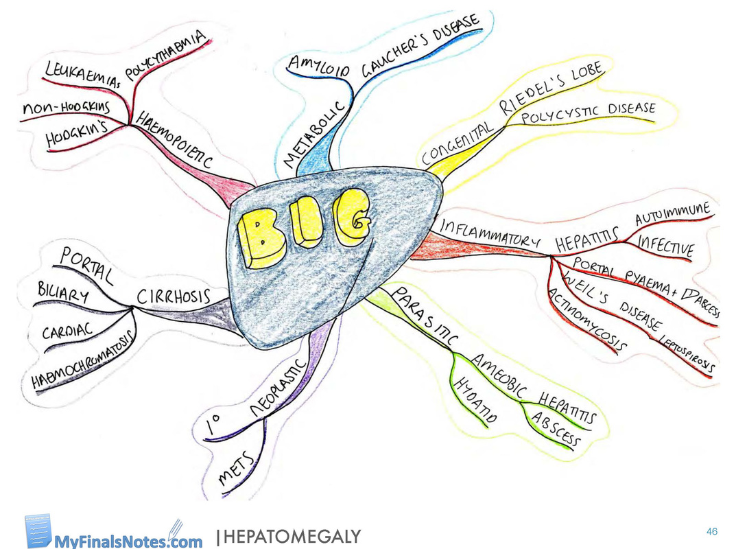 Hepatomegaly mind map, Hepatomegaly causes