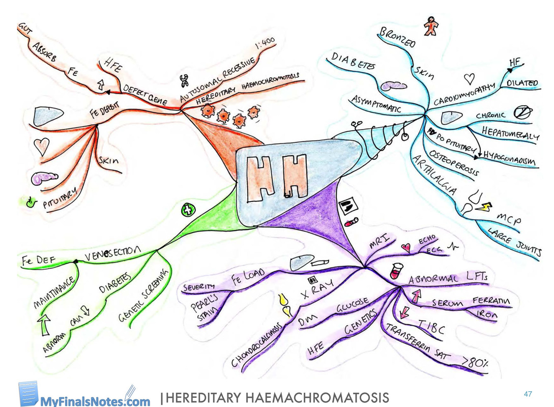 Hereditary Haemochromatosis mind map, Hereditary Haemochromatosis revision notes, Hereditary Haemochromatosis pathophysiology, Hereditary Haemochromatosis clinical features, Hereditary Haemochromatosis investigations, Hereditary Haemochromatosis management
